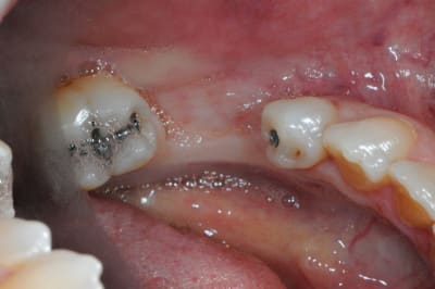 Dsc 1694 cuc92d - Eugenol