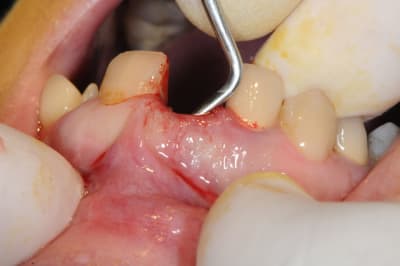 Dsc 1696 jcxykf - Eugenol