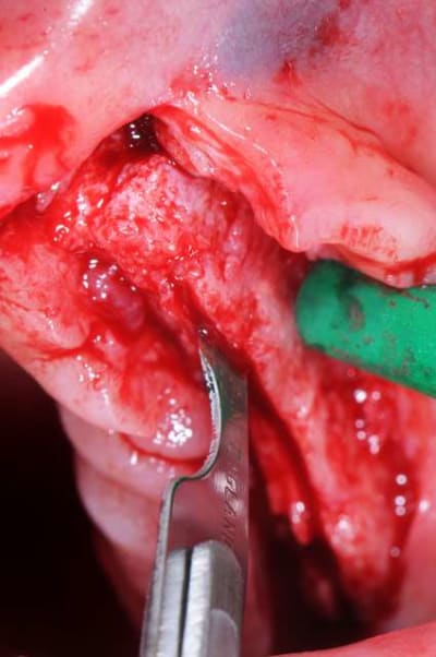 Dsc 1699 fx3jcx - Eugenol