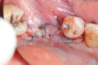 Dsc 1708 zes4ec - Eugenol