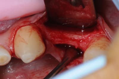 Dsc 2473 jes7zb - Eugenol