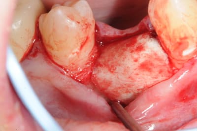 Dsc 2486 mucl51 - Eugenol