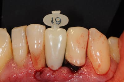 Dsc 2562 dk2vxb - Eugenol