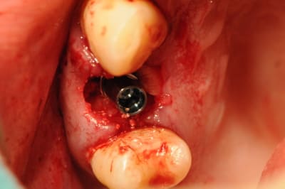 Dsc 2568 duvbud - Eugenol