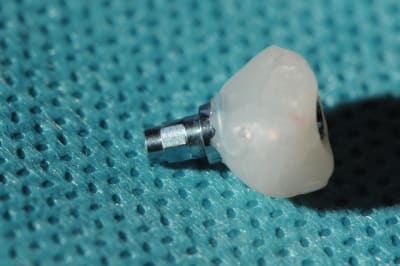 Dsc 2594 u4nfxj - Eugenol