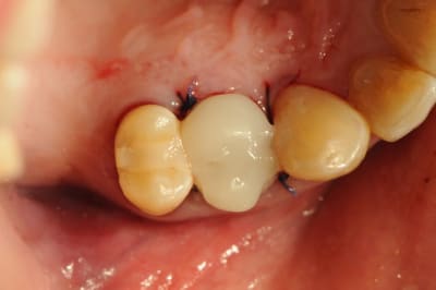 Dsc 2608 gq8iiw - Eugenol