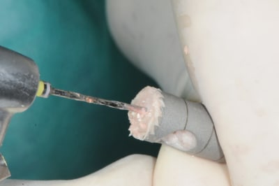 Dsc 2724 zjq2c4 - Eugenol