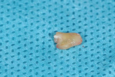Dsc 2788 t4ywjq - Eugenol