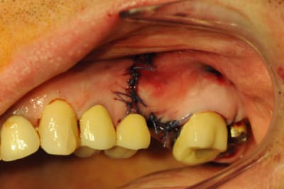 Dsc 2853 shnqvf - Eugenol