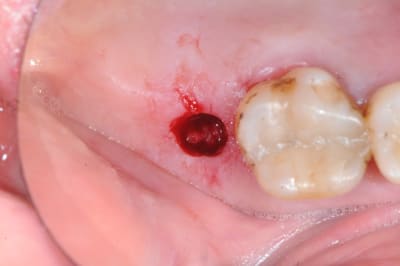 Dsc 2856 qb1vkl - Eugenol