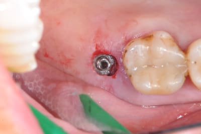 Dsc 2857 hknmf4 - Eugenol