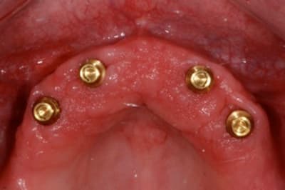 Dsc 2883 2 2 wehn2g - Eugenol