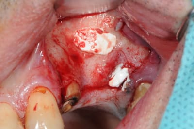 Dsc 2979 seoko1 - Eugenol