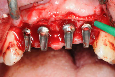 Dsc 3007 uyvxs6 - Eugenol
