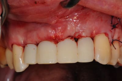 Dsc 3022 zqfcok - Eugenol