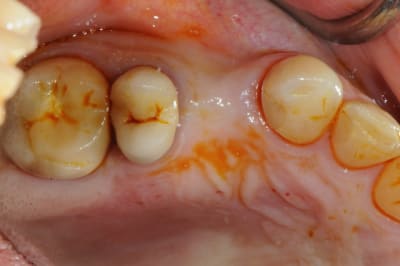 Dsc 3124 ysmqw7 - Eugenol