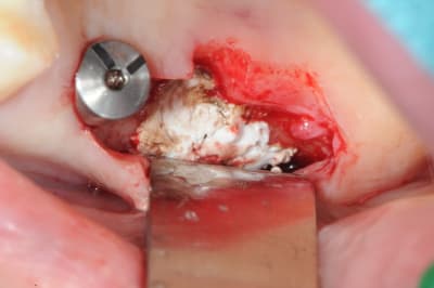 Dsc 3573 euvpvm - Eugenol