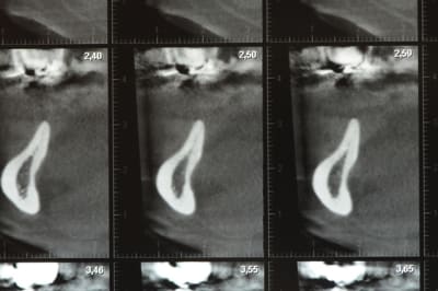 Dsc 3597 cbqdlc - Eugenol