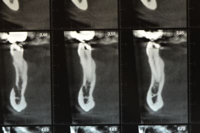 Dsc 3601 e1fkwn - Eugenol