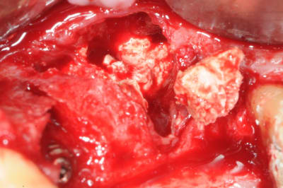 Dsc 3655 ga9s0j - Eugenol