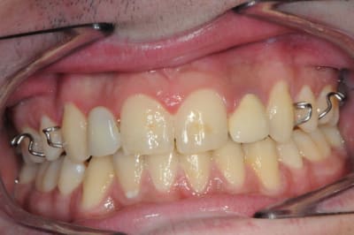 Dsc 3714 yy3w2j - Eugenol