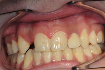 Dsc 3715 lv6kac - Eugenol