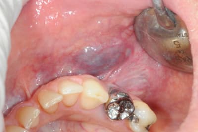 Dsc 3880 jwxukx - Eugenol