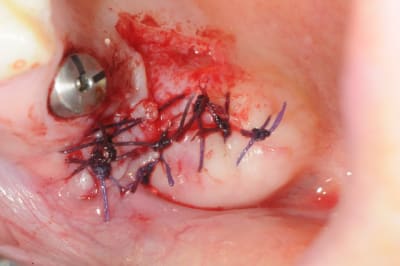 Dsc 3889 xlsx9f - Eugenol