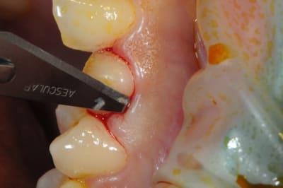 Dsc 3940 vsupws - Eugenol