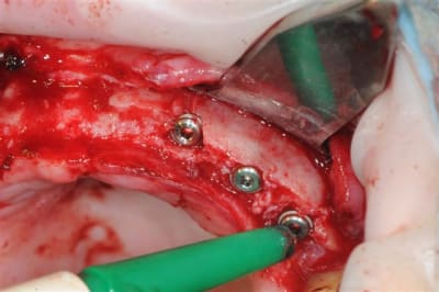 Dsc 3977 zwcvkp - Eugenol