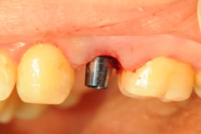 Dsc 4113 ajgjnx - Eugenol