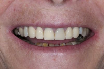 Dsc 4146 yxh7zi - Eugenol