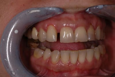 Dsc 4188 ask63h - Eugenol