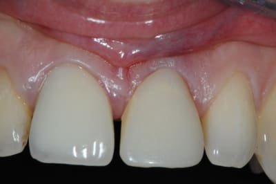Dsc 4246 f5h7fh - Eugenol