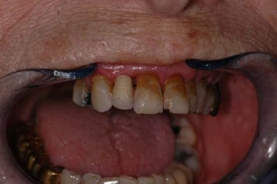 Dsc 4348 ibu5uz - Eugenol