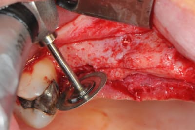 Dsc 4559 wtnful - Eugenol