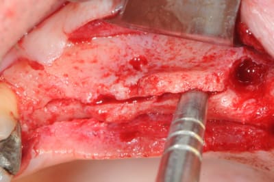 Dsc 4563 efcke3 - Eugenol