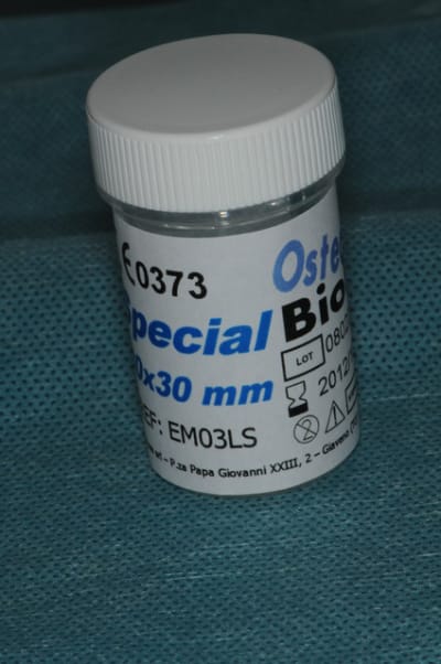 Dsc 4595 uxmest - Eugenol