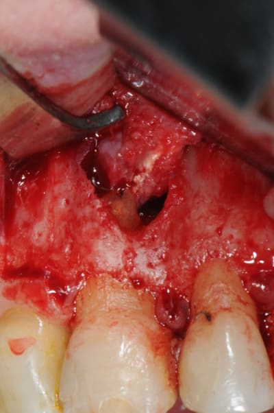 Dsc 4990 wdekkn - Eugenol