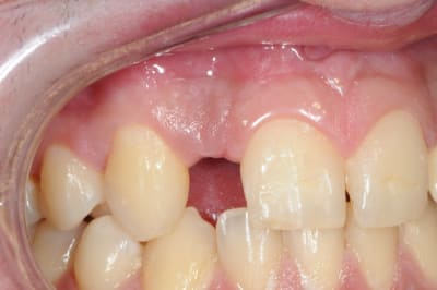 Dsc 5174 ymu9kx - Eugenol