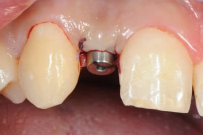 Dsc 5196 ebsolx - Eugenol