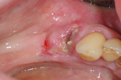 Dsc 5526 nzojoa - Eugenol