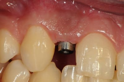 Dsc 5555 q88nfw - Eugenol