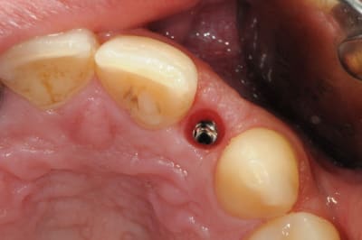 Dsc 5556 c6z9p2 - Eugenol