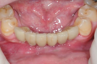 Dsc 5619 wuk8et - Eugenol