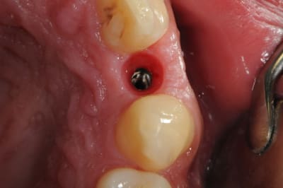 Dsc 5667 brueel - Eugenol