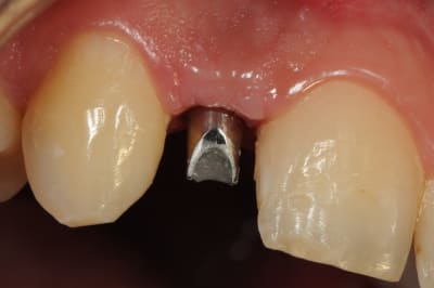 Dsc 5685 qmarax - Eugenol