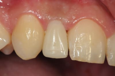 Dsc 5686 toe2fv - Eugenol