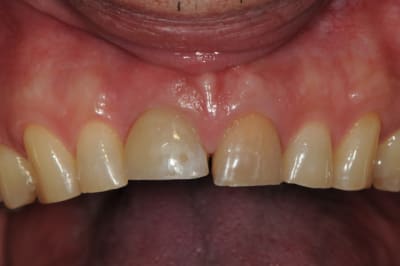 Dsc 5863 po3n1w - Eugenol