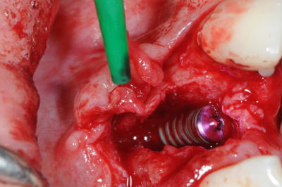 Dsc 5976 ypz4oc - Eugenol